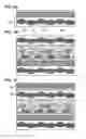 Fig. 06 - Semiconductor device and method for manufacturing the same