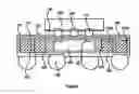 Fig. 06 - Three-dimensional system-in-package package-on-package structure