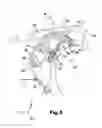Fig. 10 - Method for changing a mold