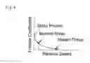 Fig. 05 - Method and apparatus for compressing particulate matter