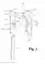 Fig. 03 - Thermal overload relay