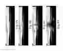Fig. 06 - Image-based barrier detection and warning system and method thereof