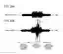 Fig. 15 - Audio signal processing device, audio signal processing method, and program