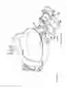 Fig. 03 - Binocular indirect ophthalmoscope