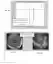 Fig. 19 - Automatic calibration systems and methods of use