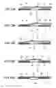 Fig. 12 - Electronic device and method for attaching actuation button