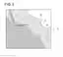 Fig. 04 - X-ray imaging apparatus including work-state detection and X-ray dosage control