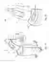 Fig. 02 - Mobile X-ray unit