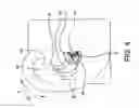 Fig. 05 - Earpiece positioning and retaining