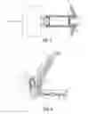 Fig. 03 - FILTER FOR A HEARING AID AND A HEARING AID