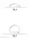 Fig. 04 - FILTER FOR A HEARING AID AND A HEARING AID