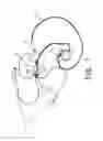 Fig. 02 - MICROPHONE-AND-EARPHONE SET WITH FUNCTIONS OF WIRE ARRANGEMENT AND WINDING