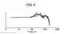 Fig. 16 - Insert earphone using a moving coil driver