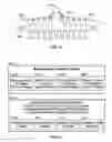 Fig. 12 - Method and apparatus for a loudspeaker assembly