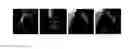 Fig. 01 - System and method for 2-D/3-D registration between 3-D volume and 2-D angiography