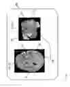 Fig. 04 - METHOD AND DEVICE FOR VISUALIZING HUMAN OR ANIMAL BRAIN SEGMENTS