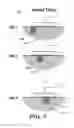 Fig. 10 - Time-domain estimator for image reconstruction