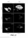 Fig. 15 - Time-domain estimator for image reconstruction