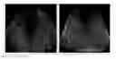 Fig. 01 - Non-Invasive Imaging-Based Prostate Cancer Prediction