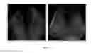 Fig. 05 - Non-Invasive Imaging-Based Prostate Cancer Prediction