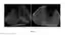 Fig. 06 - Non-Invasive Imaging-Based Prostate Cancer Prediction