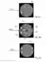 Fig. 06 - Method for inspection and detection of defects on surfaces of disc-shaped objects and computer system with a software product for carrying out the method