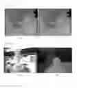 Fig. 09 - Stereo matching by census transform and support weight cost aggregation