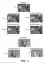 Fig. 13 - Method for encoding and simultaneously decoding images having multiple color components