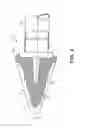 Fig. 03 - Dispensing applicator for fluids