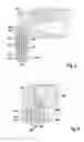 Fig. 05 - Ceramic injection needle