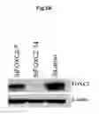 Fig. 03 - Methods of diagnosing, preventing and treating cancer metastasis