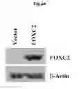 Fig. 08 - Methods of diagnosing, preventing and treating cancer metastasis