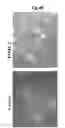 Fig. 13 - Methods of diagnosing, preventing and treating cancer metastasis