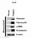 Fig. 15 - Methods of diagnosing, preventing and treating cancer metastasis