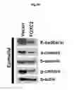 Fig. 16 - Methods of diagnosing, preventing and treating cancer metastasis