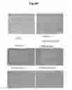 Fig. 19 - Methods of diagnosing, preventing and treating cancer metastasis