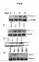 Fig. 20 - Methods of diagnosing, preventing and treating cancer metastasis