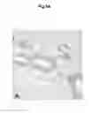 Fig. 22 - Methods of diagnosing, preventing and treating cancer metastasis