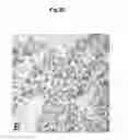 Fig. 26 - Methods of diagnosing, preventing and treating cancer metastasis