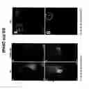 Fig. 13 - PREDICTIVE ASSAYS FOR CELL TRANSPLANTATION EFFICACY AND METHODS OF USING HUMAN NEUROPOTENTIATING CELLS