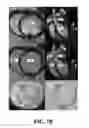 Fig. 09 - IMAGING OF BIOLOGICAL TISSUE UTILIZING NANOPARTICLES