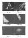 Fig. 04 - METHODS OF GENERATING HUMAN CARDIAC CELLS AND TISSUES AND USES THEREOF