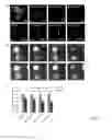 Fig. 06 - MEANS AND METHODS FOR COUNTERACTING POLYQ EXPANSION DISORDERS