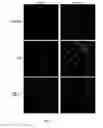 Fig. 05 - Methods for treatment of muscular dystrophy