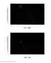 Fig. 13 - Methods for treatment of muscular dystrophy