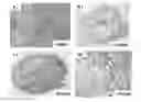 Fig. 01 - Antibodies which bind to the human CC chemokine receptor 4 and uses thereof