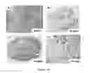 Fig. 17 - Antibodies which bind to the human CC chemokine receptor 4 and uses thereof