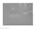 Fig. 01 - Porcine circovirus type 2 (PCV2), immunogenic composition containing the same, test kit, and application thereof