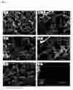 Fig. 02 - Chitosan hydrogel derivatives as a coating agent with broad spectrum of antimicrobial activities