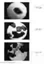 Fig. 06 - Bone graft materials  and methods